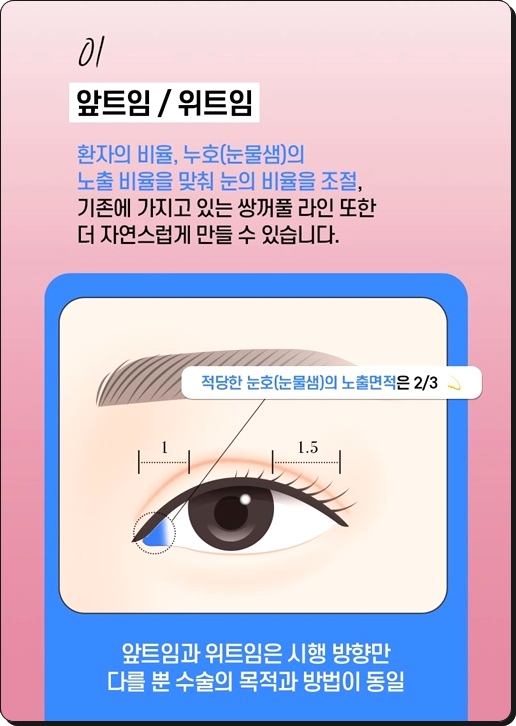 If You Have Been Looking Into Outer Corner and Lower Corner Eye Surgery Reviews, and Eye Corner Surgery Prices image 8