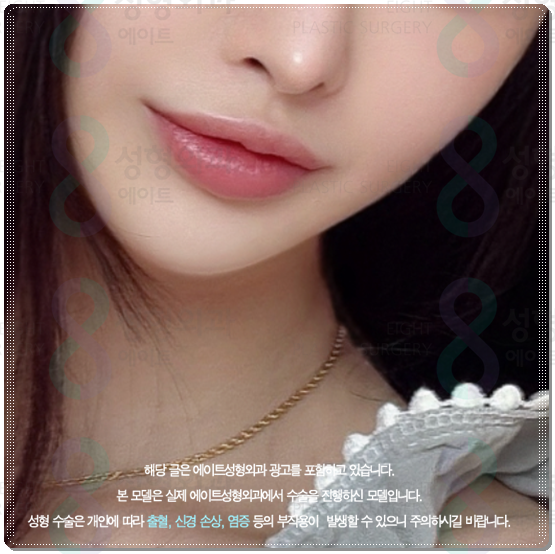 Gangnam) How Much Does 300 Shots of Ultherapy Cost? Treatment Time, Frequency, and Before-and-After Results (Ultherapy PRIME) image 3