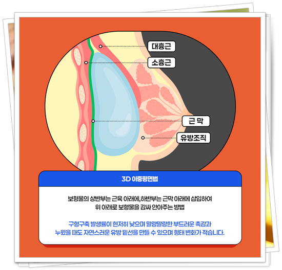 Breast Ptosis Surgery Price, How Are the Reviews? image 9