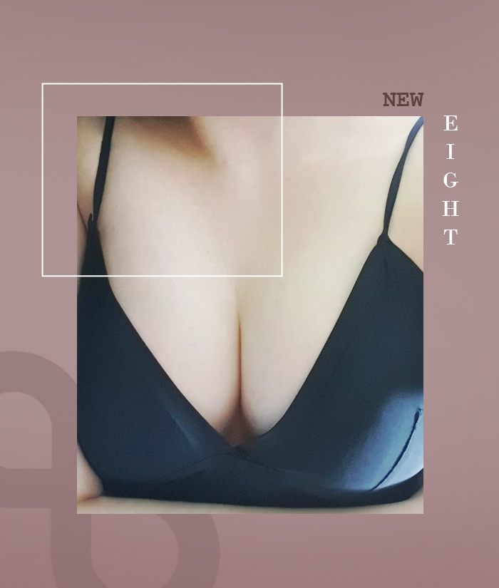 Comparing Before-and-After Feelings Through Breast Augmentation Surgery Reviews image 7