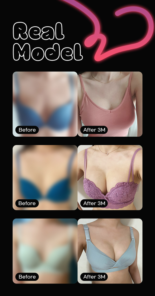 Choosing the Right Type of Breast Augmentation image 2