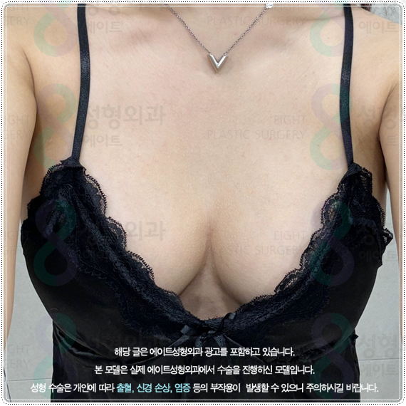 How to Find a Well-Known Breast Plastic Surgery Clinic in Seoul’s Gangnam District: Selection Criteria and Points to Check image 2