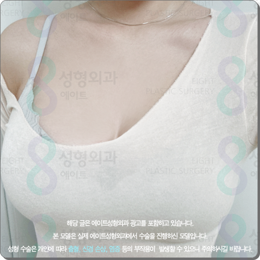 Where Should You Get Motiva Breast Augmentation? Costs and Surgery Tips from a Reputable Clinic image 2