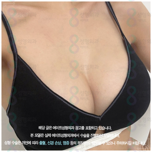 처진가슴 리프팅 수술, 출산후 수유후, 가슴 올리기, 보형물로 가능한가요? 관련 이미지 2