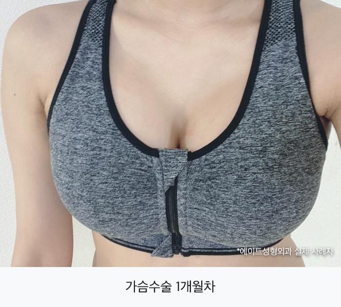 강남가슴수술 자신감까지 채우게 관련 이미지 3