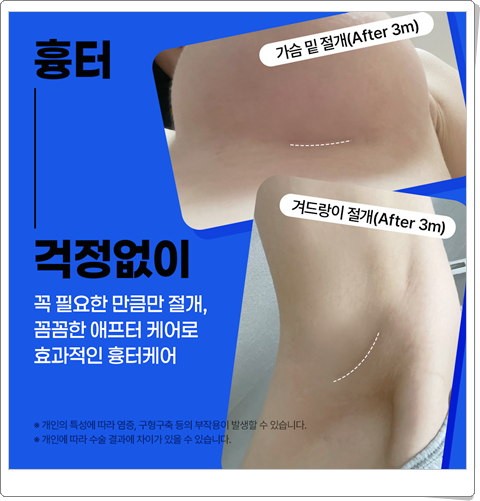 멘토 엑스트라 가격 후기가 궁금하실땐 관련 이미지 8
