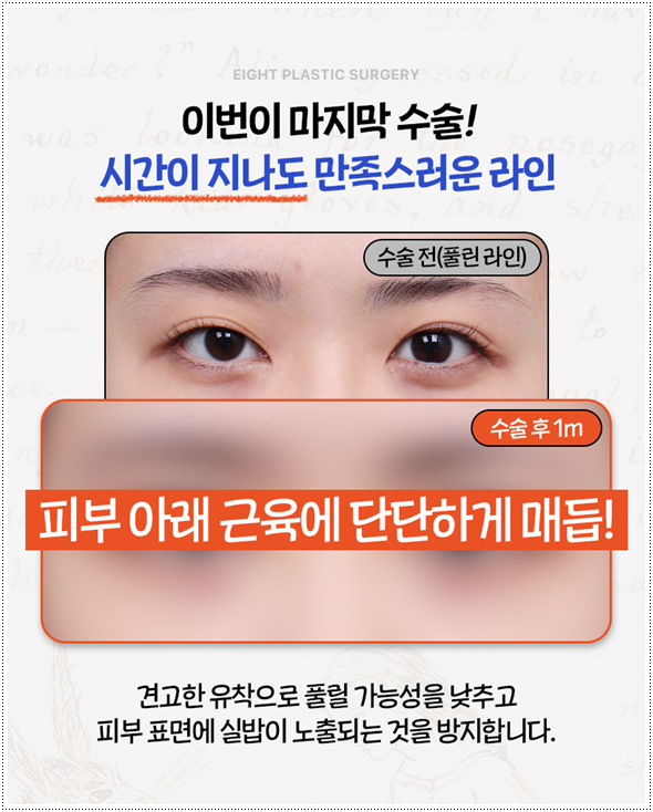 쌍커풀재수술 절개쌍수 말고 매몰은 못하나? 재수술 시 가격 얼마? 관련 이미지 8