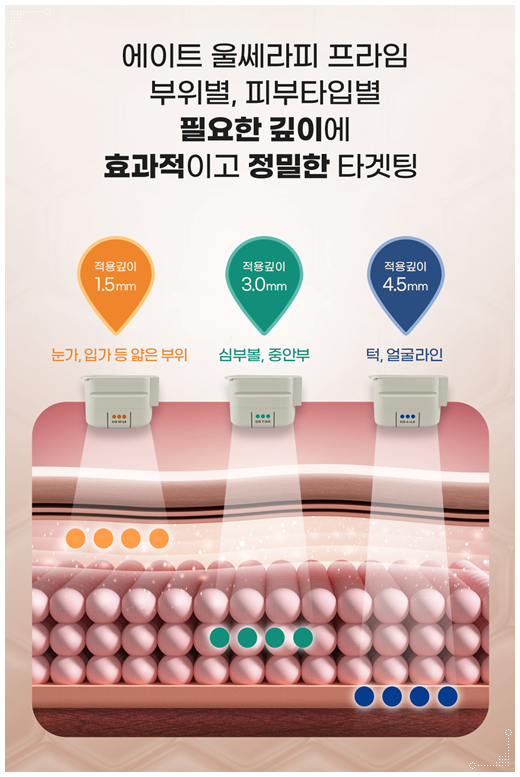 울쎄라 리프팅은 300샷으로 어느정도 효과가 있을까? 관련 이미지 12