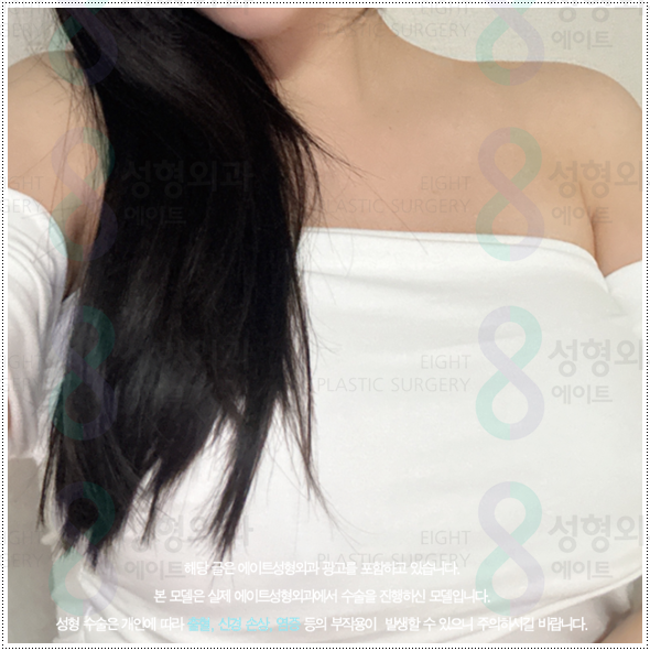 수술 비용이 부담되나요? 가슴수술 준비할 때 처진 가슴은 어떤 방법이 좋나요? 관련 이미지 4