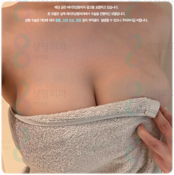 가슴확대수술, 후기와 비용·붓기·회복 기간은 어떻게 될까? 관련 이미지 1
