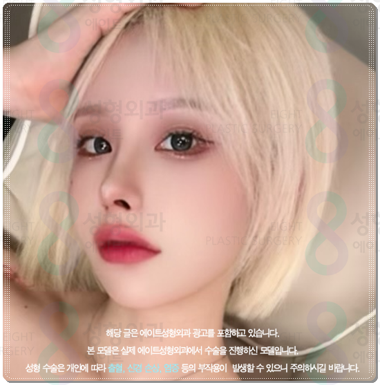 How Much Is a Reasonable Cost for Non-Incisional Ptosis Correction to Escape Sleepy-Looking Eyes? (Including the Differences from Incisional Surgery and Recovery Time) image 5
