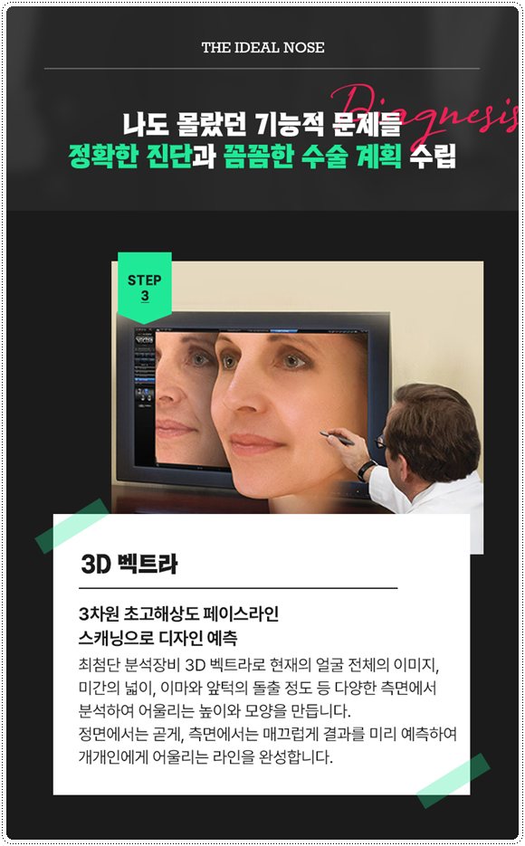 복코성형 콧볼축소 1개월 차! 코성형 붓기 빨리 빼는법과 코끝수술 후기 찾으셨나요? 관련 이미지 14
