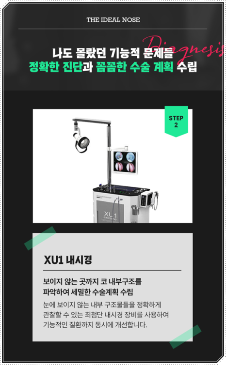 남자 코성형 종류 어떤 게 맞을까? 평균 비용부터 회복기간, 발품 팁까지 완벽 가이드 관련 이미지 11