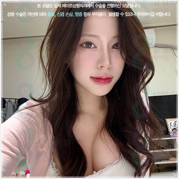 여자와 남자의 코성형 수술 차이점과 비용, 보형물 선택 가이드 관련 이미지 1
