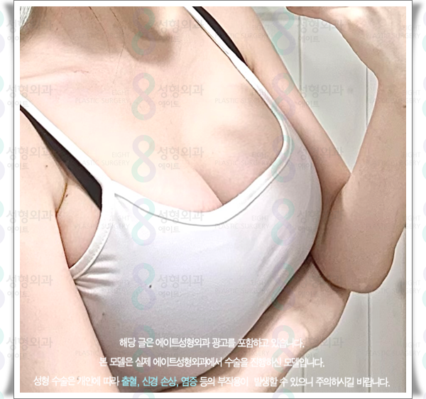 처진가슴수술 방법은? 가슴성형 보형물 선택과 멘토부스트 후기 특징 정리 관련 이미지 3