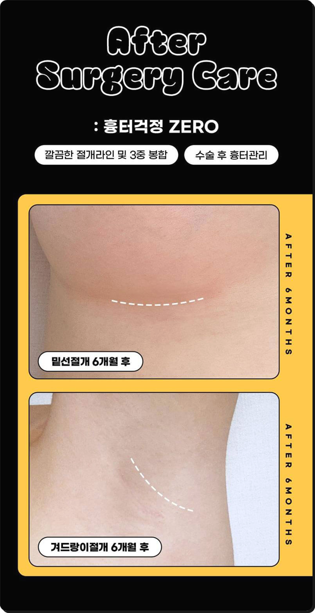 Breast Augmentation Surgery Cost (Price) and the Secret to a Review with No Side Effects Before and After? image 7