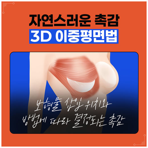 처진가슴 리프팅 수술, 출산후 수유후, 가슴 올리기, 보형물로 가능한가요? 관련 이미지 21