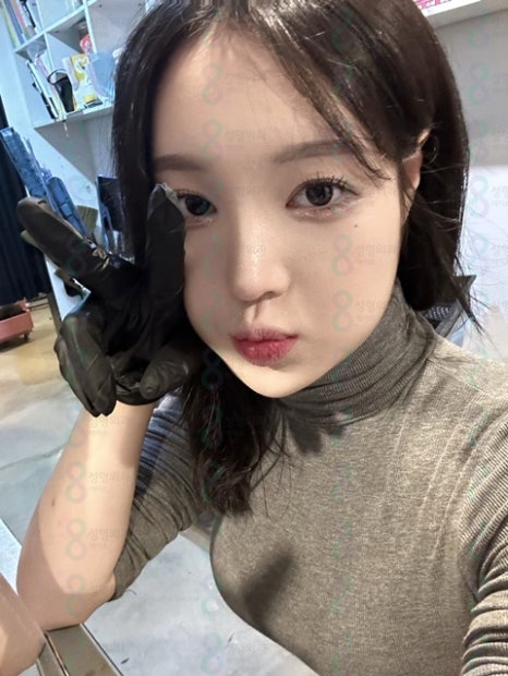 압구정눈매교정 눈매교정잘하는곳 눈매교정유명한병원 안검하수잘하는병원 관련 이미지 1