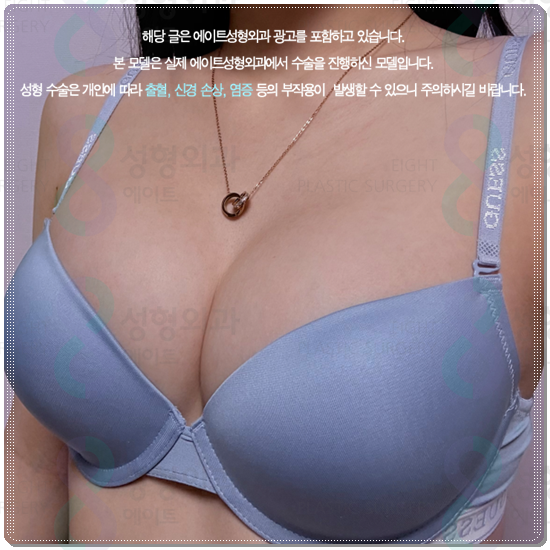 가슴없이 사는 고민? 가슴성형 수술 가격과 부작용 부담없이 가슴 커지는 법에 대해 관련 이미지 1
