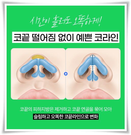코끝수술 잘하는곳, 예쁜 후기, 가격 정보, 콧볼축소 뭐가 다른가요? 관련 이미지 8