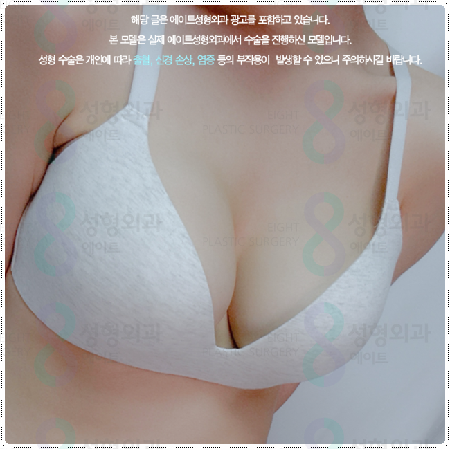 Why Should You Consider the Implant and Cost Together When Comparing Motiva Breast Augmentation Prices? image 5