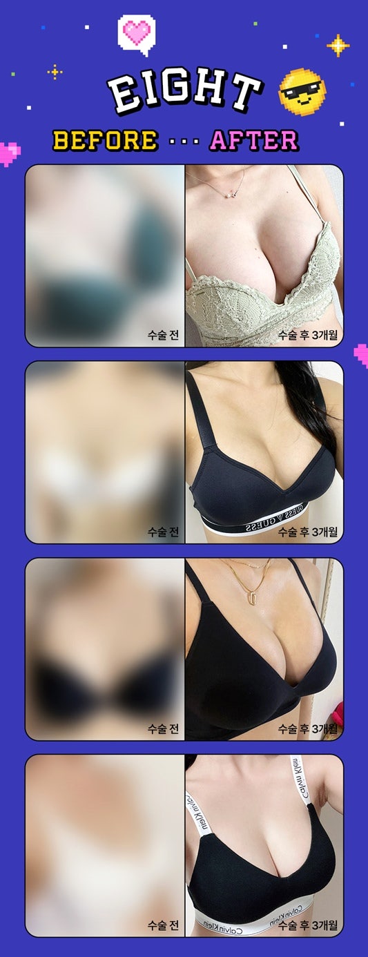 About Motiva Breast Augmentation Price and Features image 14
