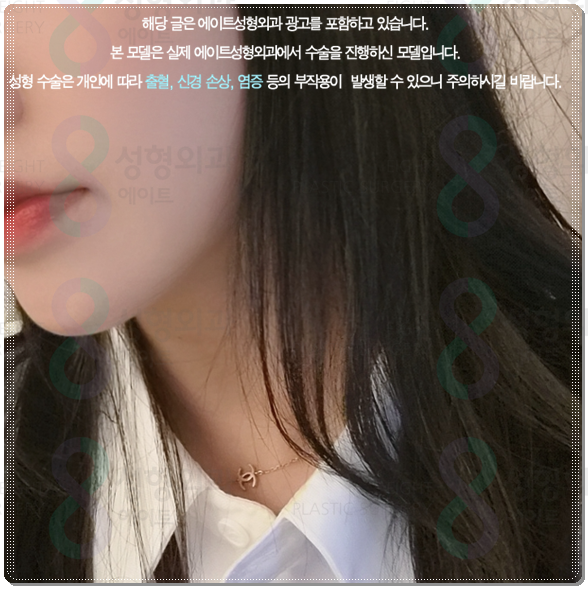 피부과 추천 정보? 울쎄라 강남 어디가 잘하는곳인가요? 수면마취, 가격 부담없이 하는법 관련 이미지 2