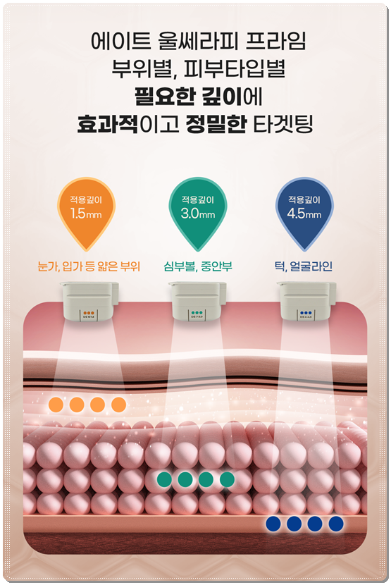 Gangnam) How Much Does 300 Shots of Ultherapy Cost? Treatment Time, Frequency, and Before-and-After Results (Ultherapy PRIME) image 12