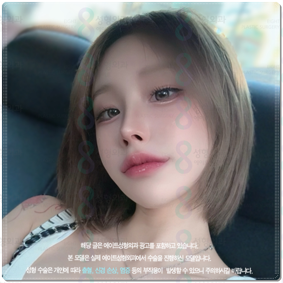 Bokko Rhinoplasty Review Summary! In Sinsa-dong, what are the costs of bokko surgery and the criteria for choosing a good clinic? image 3