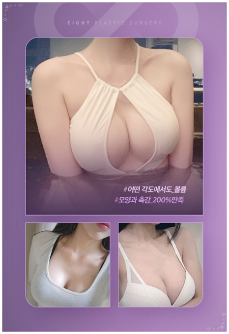 처진가슴 리프팅 수술, 출산후 수유후, 가슴 올리기, 보형물로 가능한가요? 관련 이미지 36