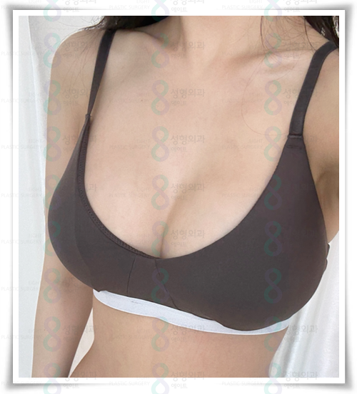 Breast Augmentation Surgery Cost: How Can Pain Be Reduced? image 6