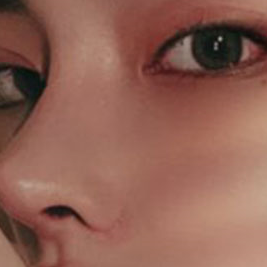 Why Facial Proportions Matter for a Straight-But-Slightly-Upturned Nose image 16