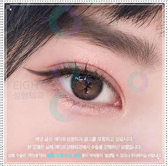 쌍커플 아웃라인과 세미아웃라인의 차이점은? 관련 이미지 5