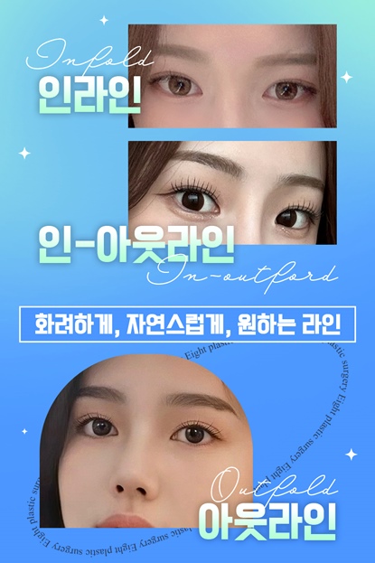 Hospitals That Are Good at Eye Plastic Surgery, Places That Are Good at Double Eyelid Surgery, Gangnam Places Good at Double Eyelid Surgery image 5