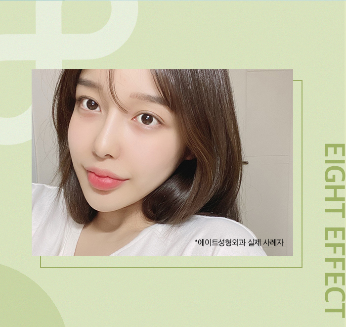 서울가슴성형 잘하는곳 아름답게 하고싶다면 관련 이미지 7