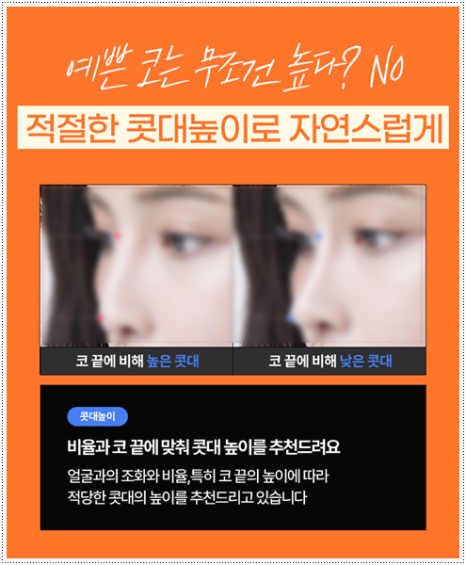 코수술 후기 일주일 1개월 비교? 평균 비용, 코성형 종류 장단점은? 관련 이미지 13