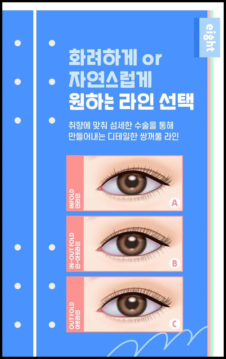 눈성형외과 내게 맞는 눈성형을 찾아요 관련 이미지 3
