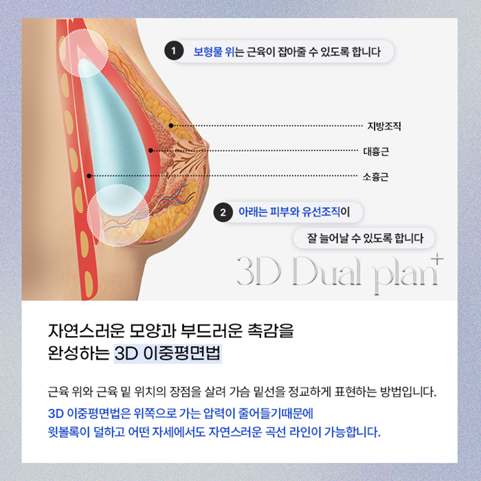물방울가슴성형비용 멘토CPG는 얼마정도할까요?? 관련 이미지 7
