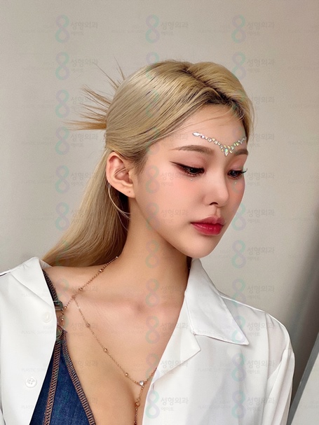 About the Difference in Hump Nose Surgery Costs Before and After for Women image 2