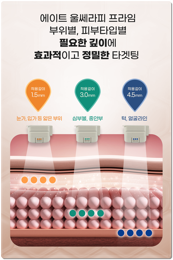 울쎄라 턱살에 효과 언제부터 있나요? (300샷 기준의 가격 평균은?) 관련 이미지 13