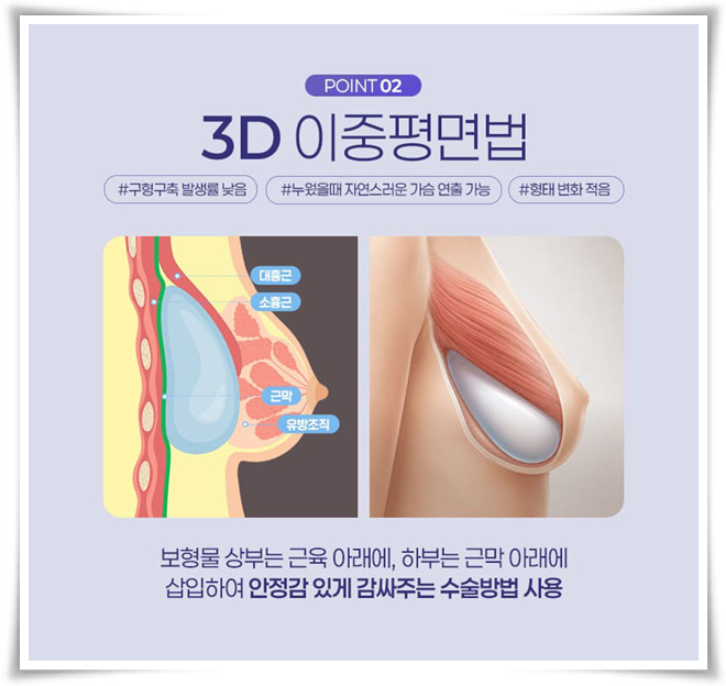 강남 가슴성형, 수술 전 비용보다 부작용을 먼저 봐야 하는 이유 관련 이미지 13