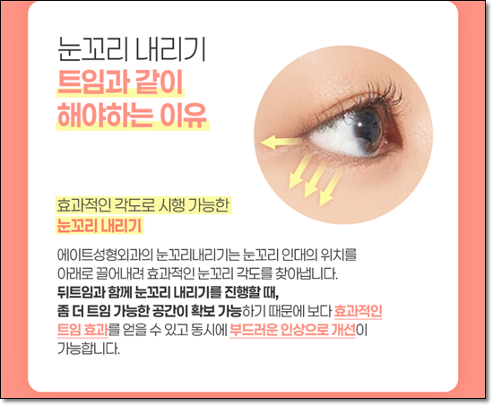 A Review of Upper Blepharoplasty Costs That Was Worth Every Penny! From How to Remove Mongolian Folds to Pricing and Recovery Care Tips image 16