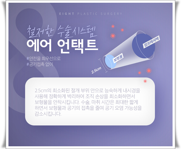 처진가슴수술 방법은? 가슴성형 보형물 선택과 멘토부스트 후기 특징 정리 관련 이미지 20