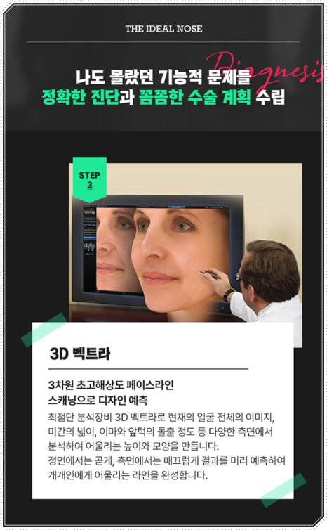 남자 코성형 종류 어떤 게 맞을까? 평균 비용부터 회복기간, 발품 팁까지 완벽 가이드 관련 이미지 12