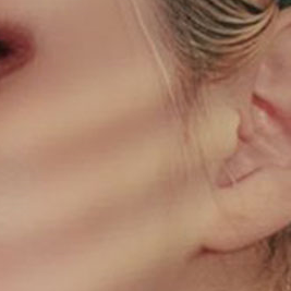 Why Facial Proportions Matter for a Straight-But-Slightly-Upturned Nose image 17