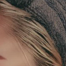 Why Facial Proportions Matter for a Straight-But-Slightly-Upturned Nose image 14