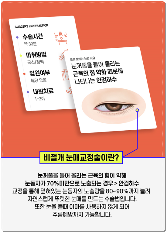 How Much Is a Reasonable Cost for Non-Incisional Ptosis Correction to Escape Sleepy-Looking Eyes? (Including the Differences from Incisional Surgery and Recovery Time) image 9