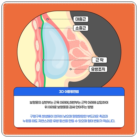 Can I Compare Breast Augmentation Surgery Costs? image 10