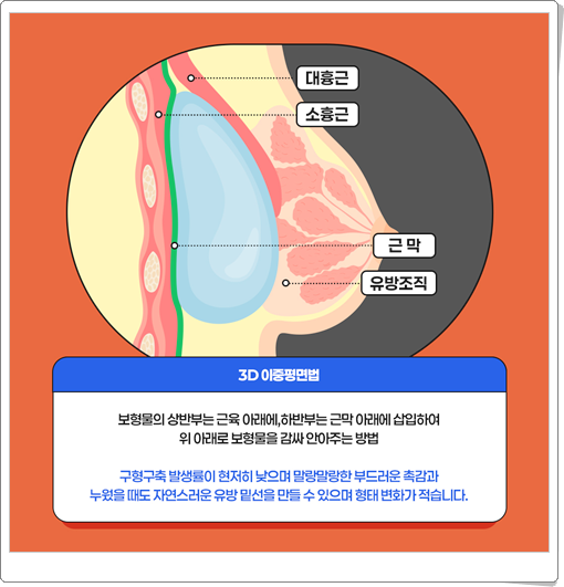 What Is the Average Cost (Price) of Breast Augmentation Surgery? image 14