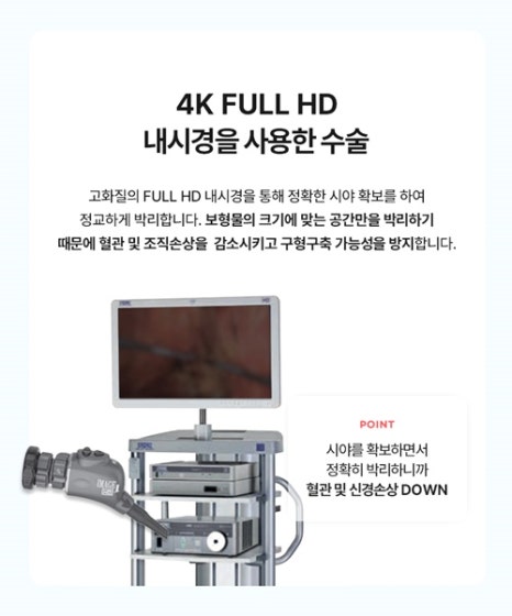 멘토엑스트라후기 서울가슴성형외과 압구정가슴성형외과 가슴수술성형외과 관련 이미지 11